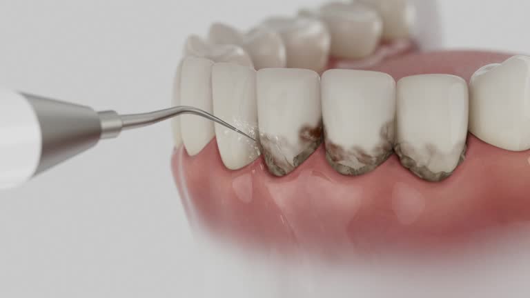 Trusted Invisalign Clear Aligners service in Conehatta, MS - Dentist Open Now